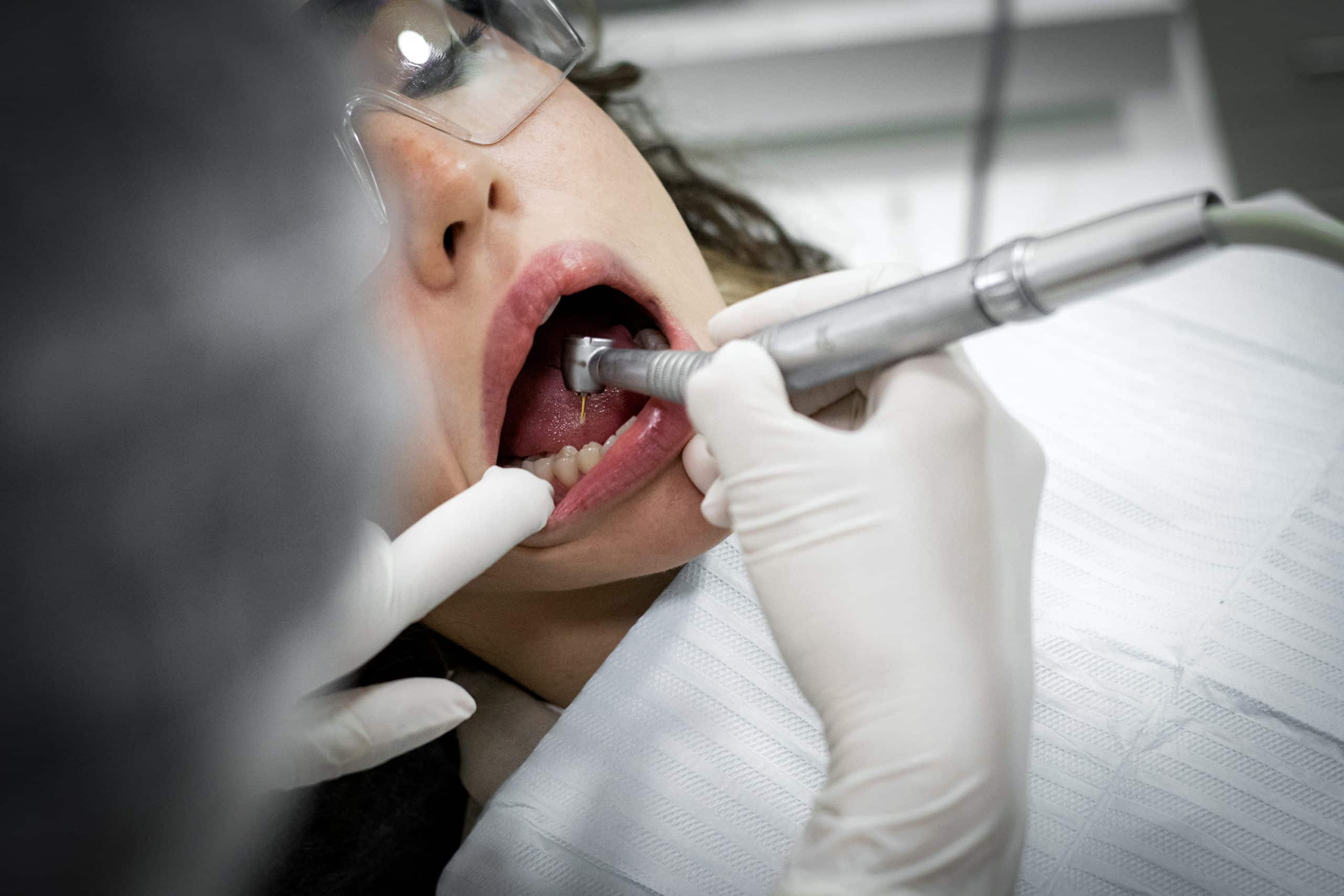 Patient souriant après une restauration dentaire
