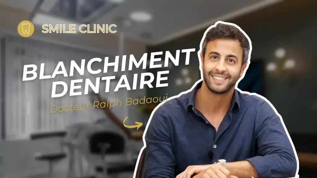 Le blanchiment dentaire à la maison