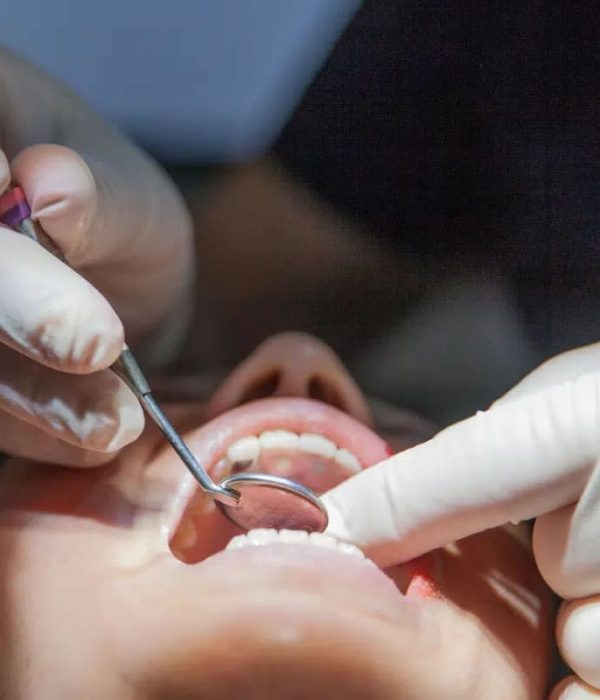 Examen clinique des gencives et diagnostic d’une récession gingivale