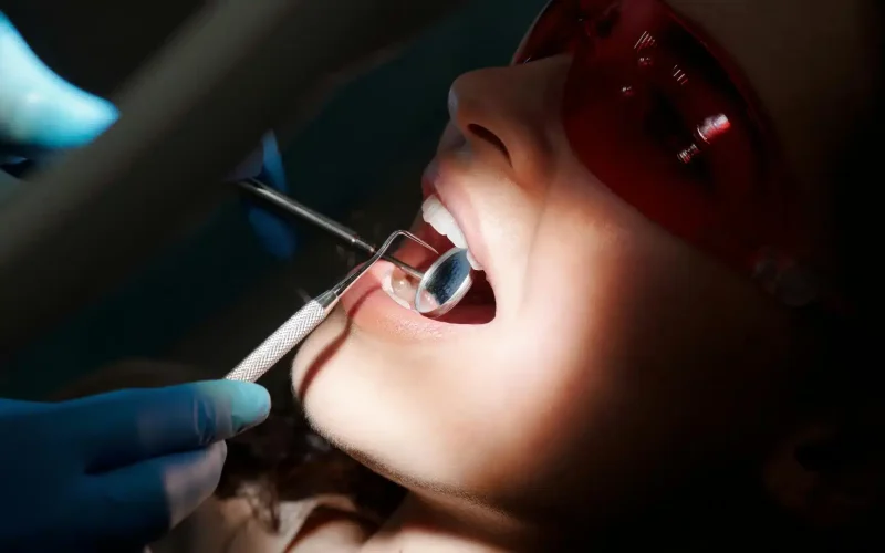 Extraction des dents de sagesse