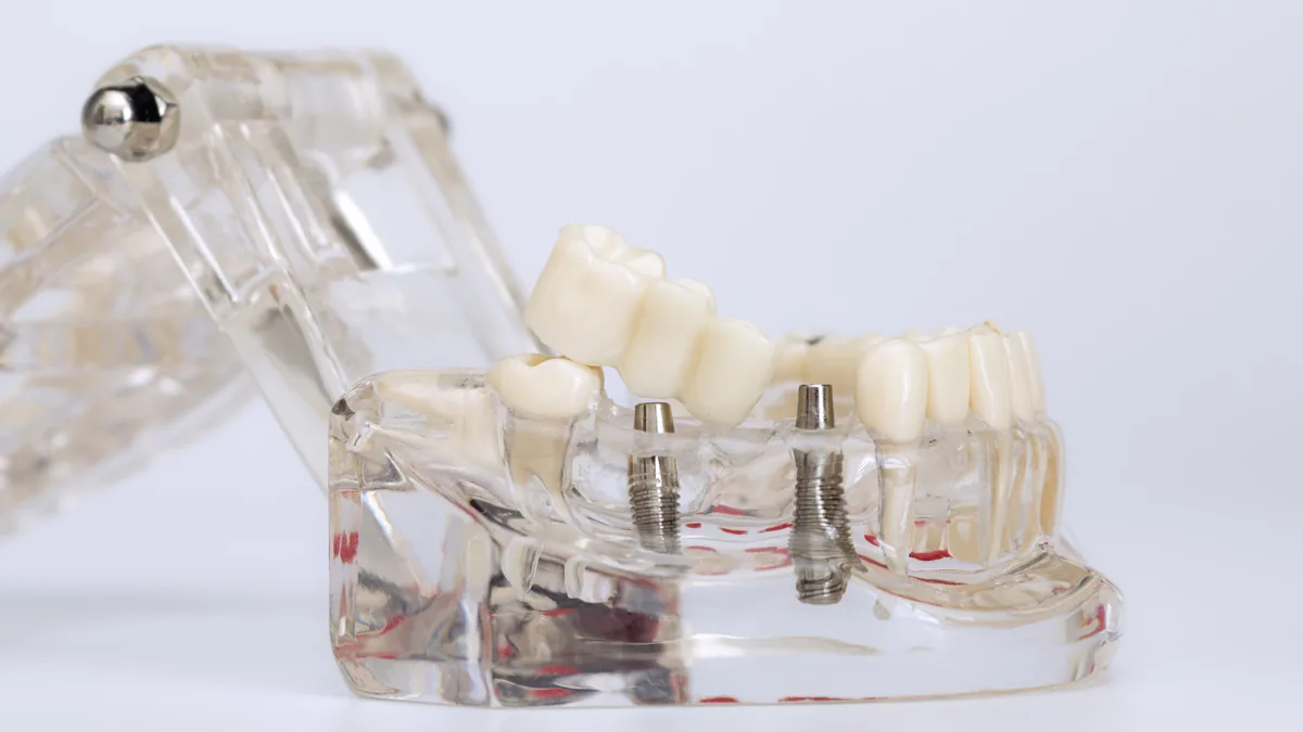 Implant dentaire